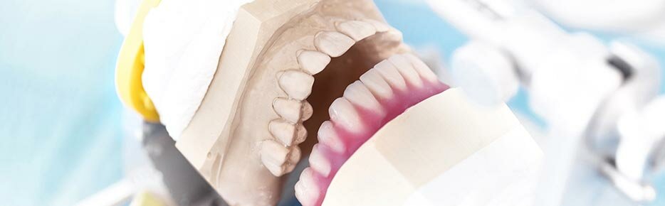 Крепкие зубы за один день | Клиника стоматологии Хардер и Мель, Мюнхен